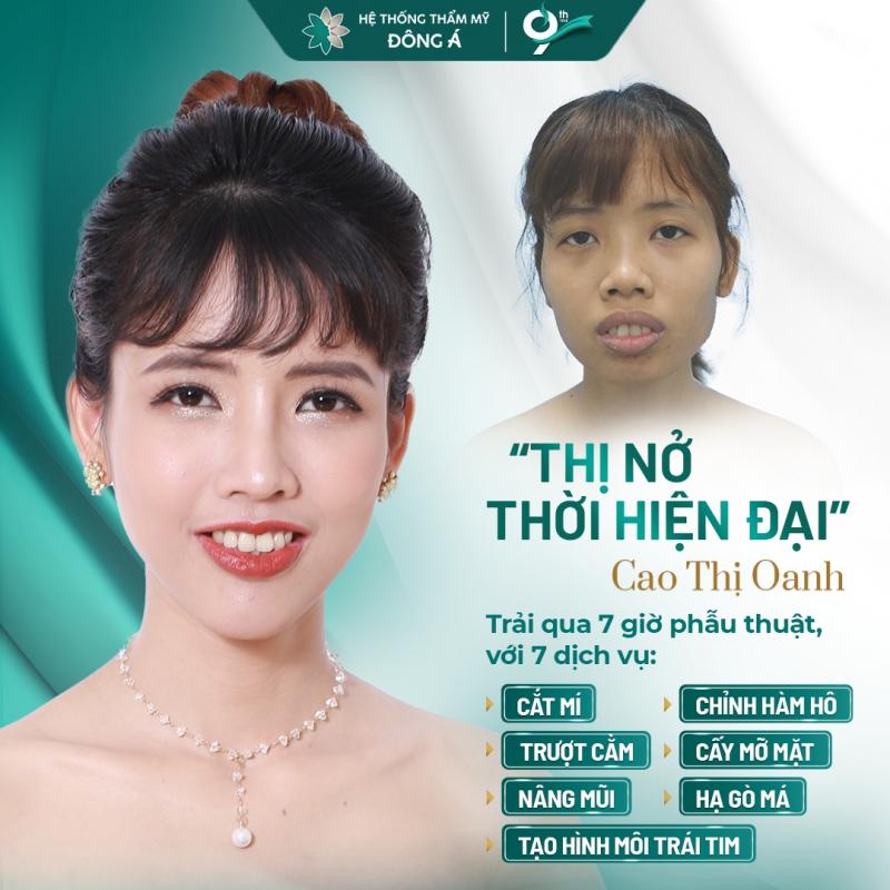 Bệnh Viện Thẩm Mỹ Đông Á