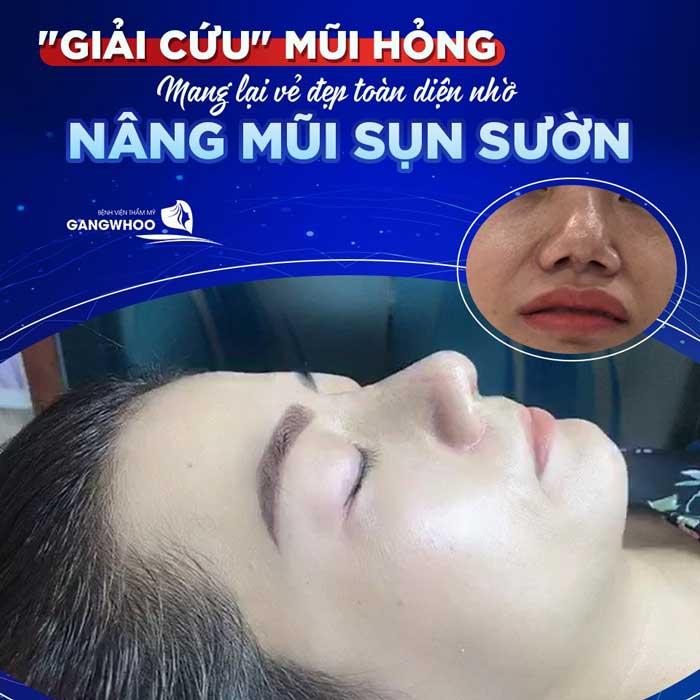 Bệnh viện thẩm mỹ Gangwhoo