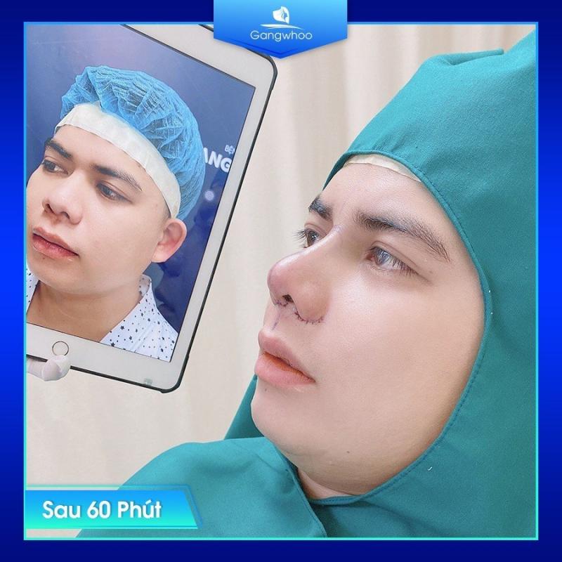 Bệnh viện thẩm mỹ Gangwhoo
