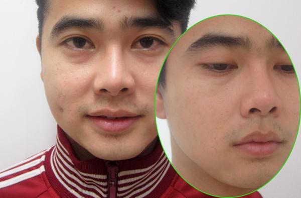 Bệnh viện Thẩm mỹ Hiệp Lợi
