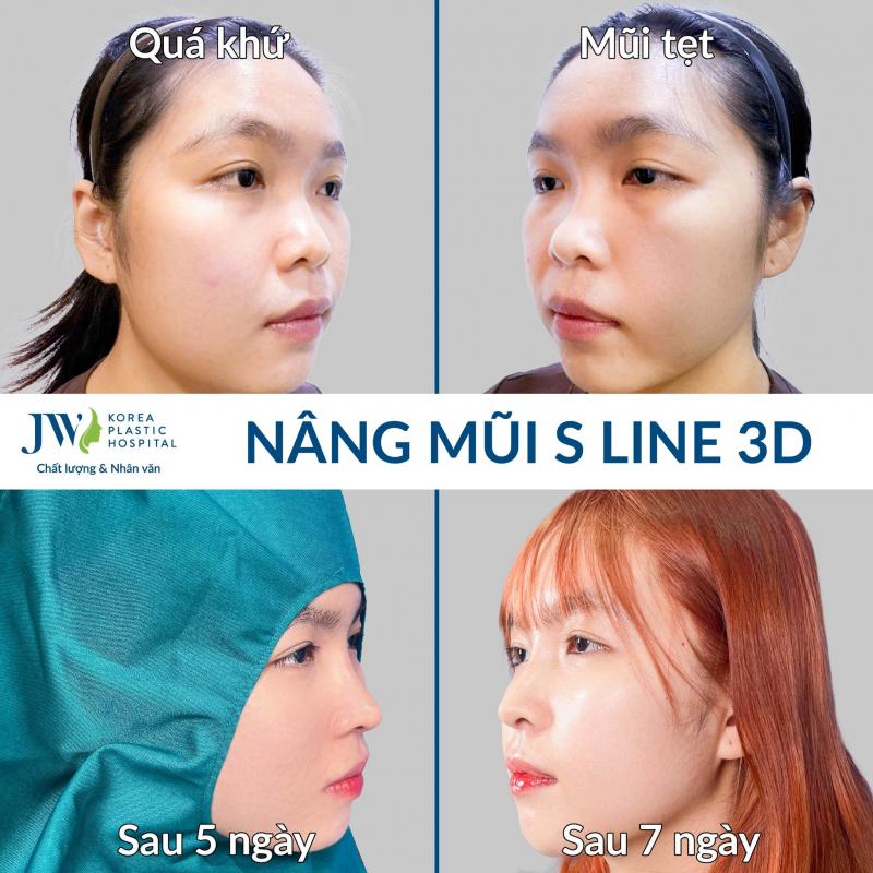 Bệnh viện Thẩm Mỹ JW Hàn Quốc