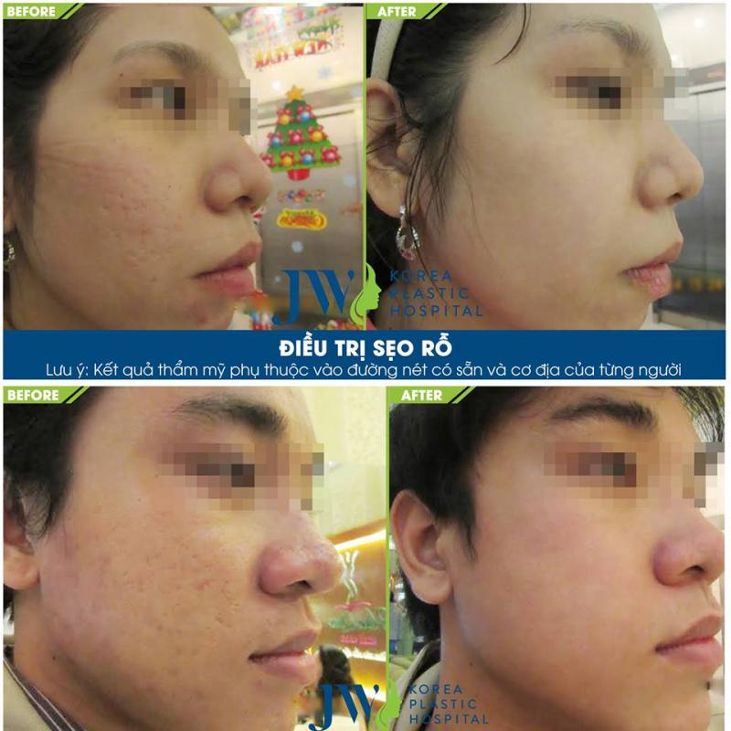 Bệnh Viện Thẩm Mỹ JW Hàn Quốc