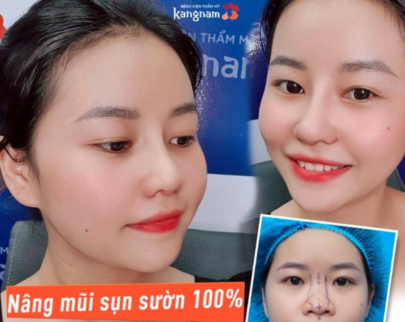 Bệnh viện thẩm mỹ Kangnam
