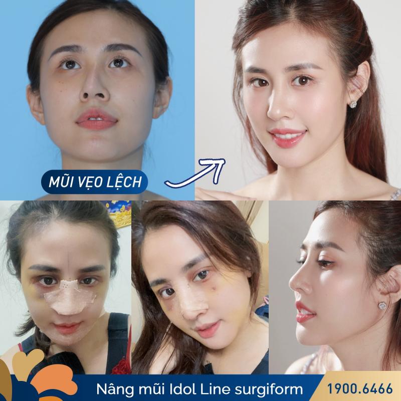 Bệnh viện thẩm mỹ Kangnam