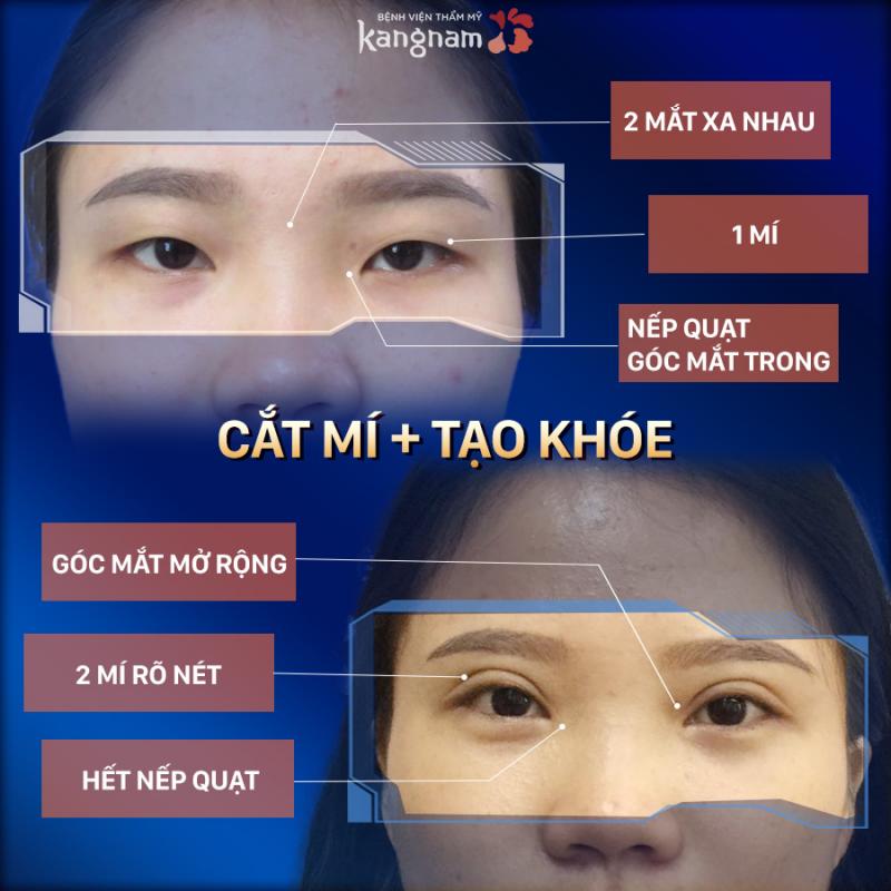 Bệnh viện thẩm mỹ Kangnam