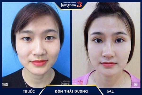Bệnh viện thẩm mỹ Kangnam