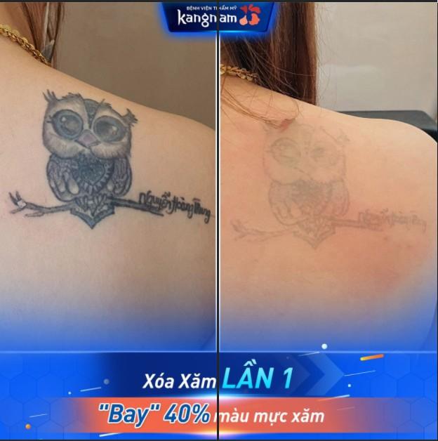 Hình xăm đã mờ đi đáng kể sau 1 buổi