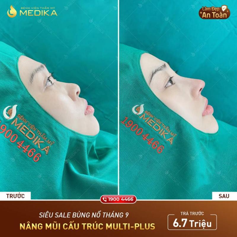 Bệnh viện thẩm mỹ MEDIKA