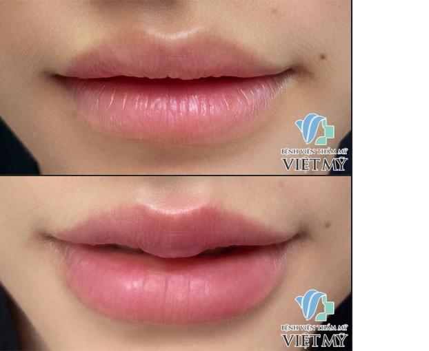 Bệnh Viện Thẩm Mỹ Việt Mỹ