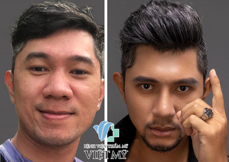 Bệnh Viện Thẩm mỹ Việt Mỹ
