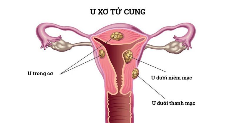 Bệnh viện Từ Dũ