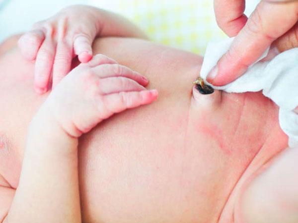 Vệ sinh và chăm sóc rốn cho trẻ sơ sinh