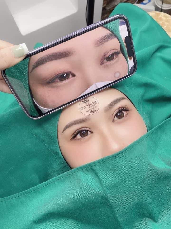 Bích Phượng - Filler & Nhấn mí - Cắt mí Gia Lai