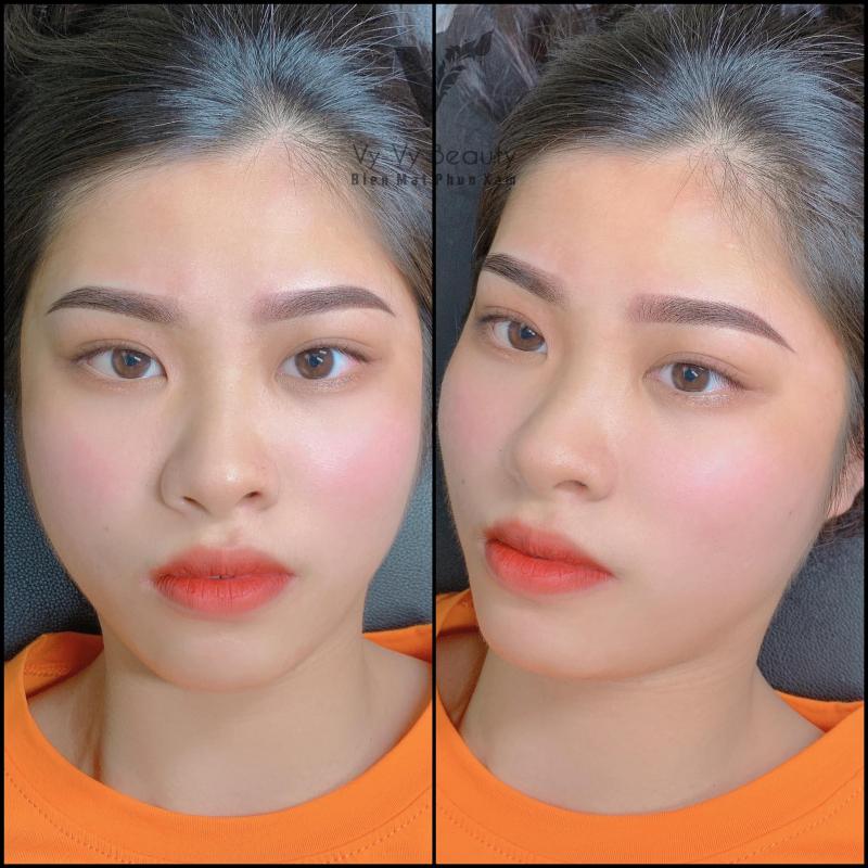 Biến mất phun xăm- Thẩm mỹ viện Vy Vy