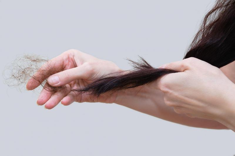 Bitino có tác dụng làm giảm triệu chứng viêm và điều trị rụng tóc