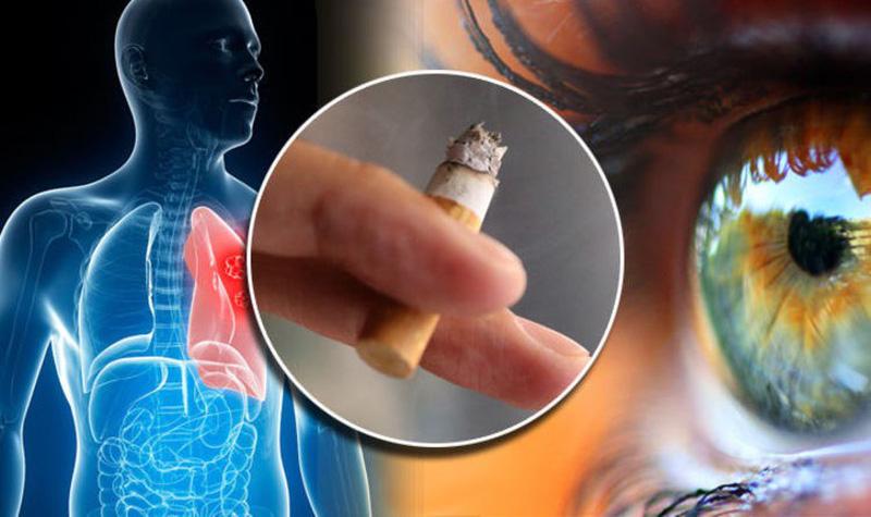 Hãy cố gắng bỏ hút thuốc lá bằng mọi giá