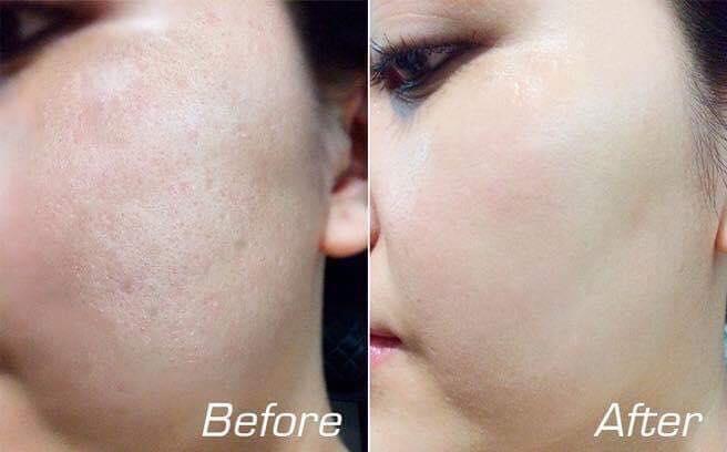 Bông Spa - Healthy & Beauty