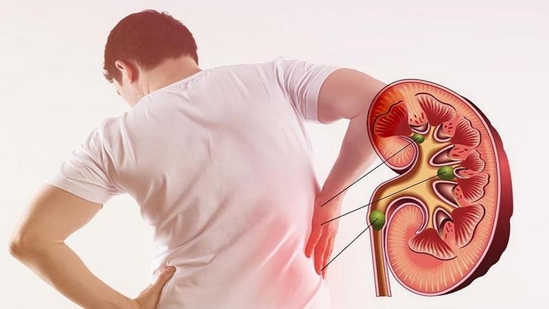 Suy thận mạn tính là bệnh lý nguy hiểm và tiến triển âm thầm