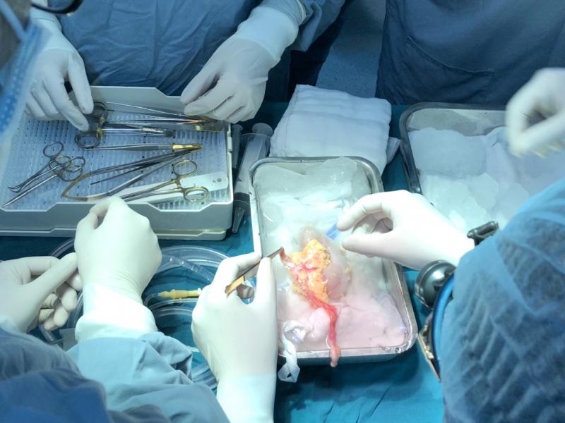 Hình ảnh trong một ca phẩu thuật ghép thận