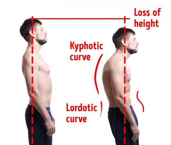Cải thiện tư thế của bạn