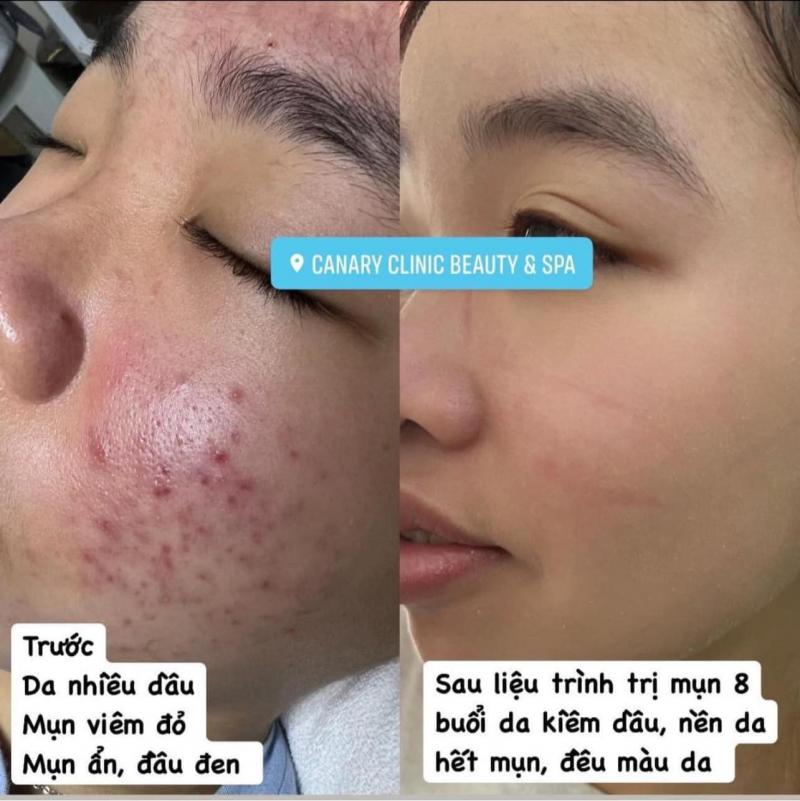 Canary Clinic Beauty & Spa