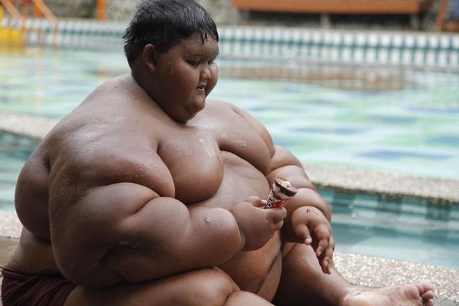Thân hình quá khổ của cậu bé 192kg