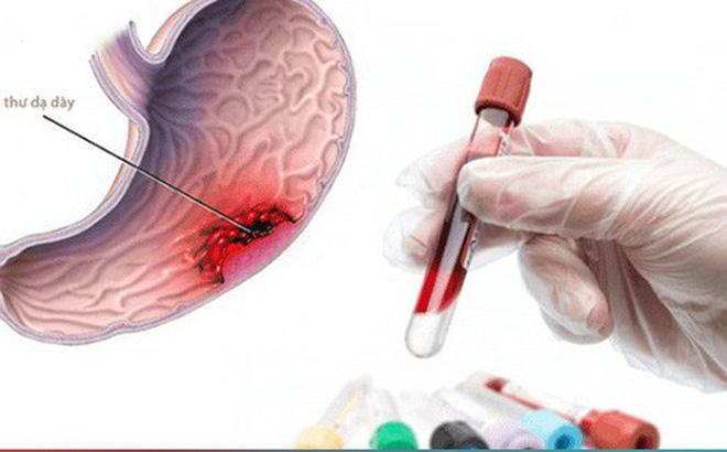 Xét nghiệm máu toàn bộ (CBC)