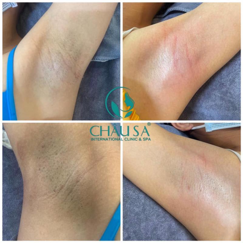 Châu Sa International Clinic & Spa