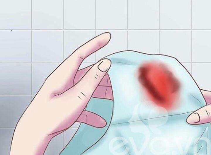 Tiểu ra máu, tiểu mủ