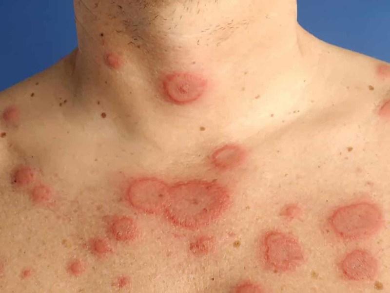 Chỉ định sản phẩm