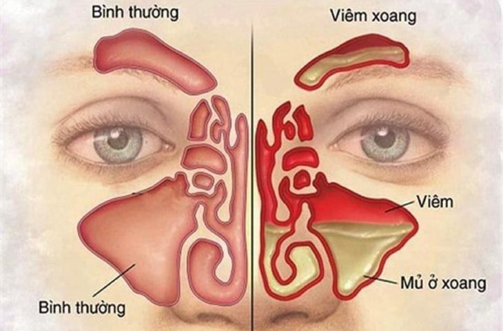 Ảnh minh họa (Nguồn internet)