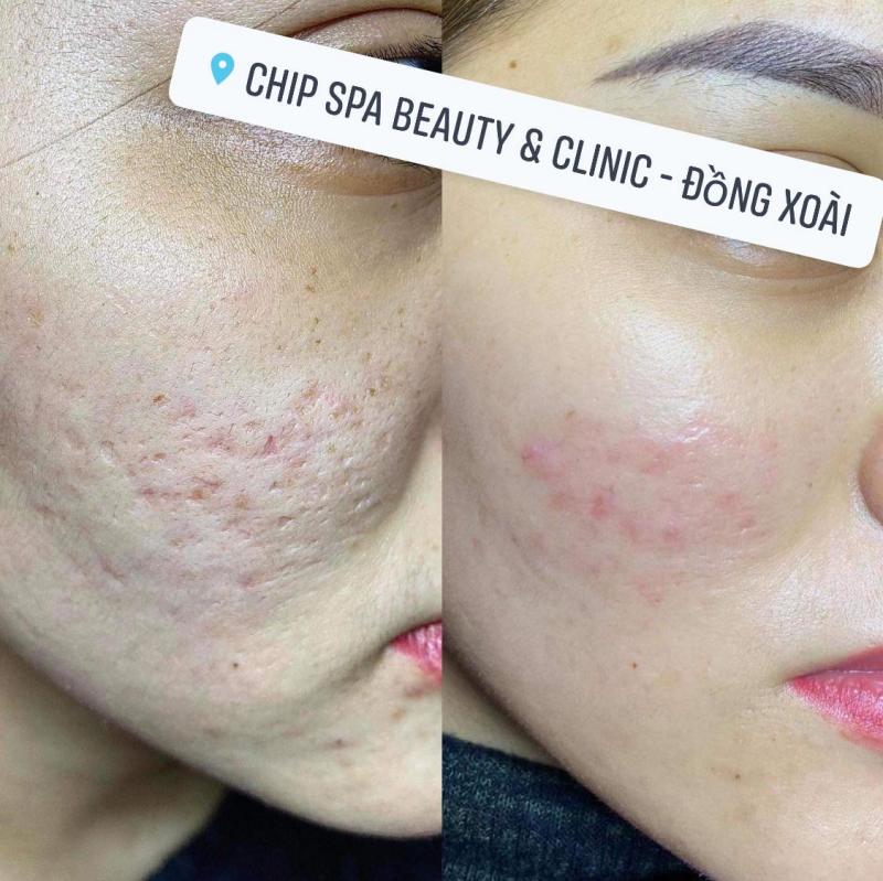 CHIP SPA Beauty & Clinic