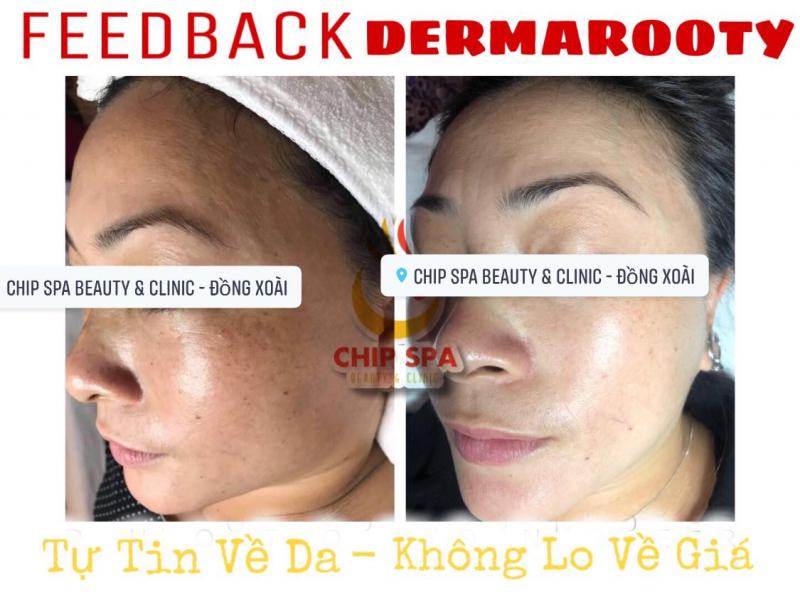 CHIP SPA Beauty & Clinic