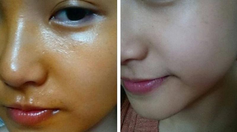 Chống lão hóa