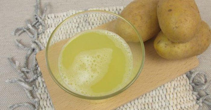 Chữa rạn da bằng nước ép khoai tây