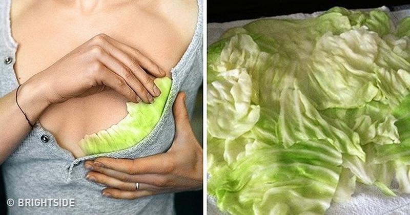 Chữa tắc tia sữa bằng lá bắp cải