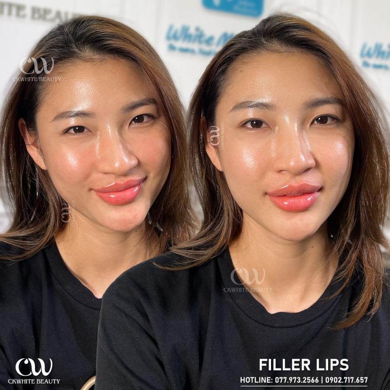 TUẤN ANH KIỀU (Viện TM Ckwhite beauty)