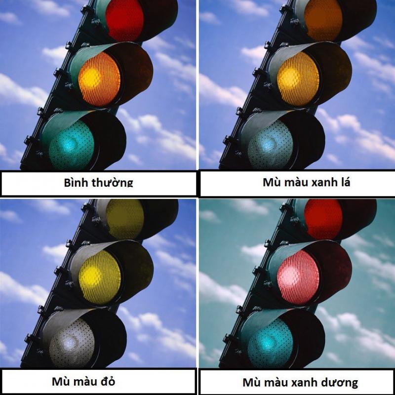 Các loại bệnh mù màu