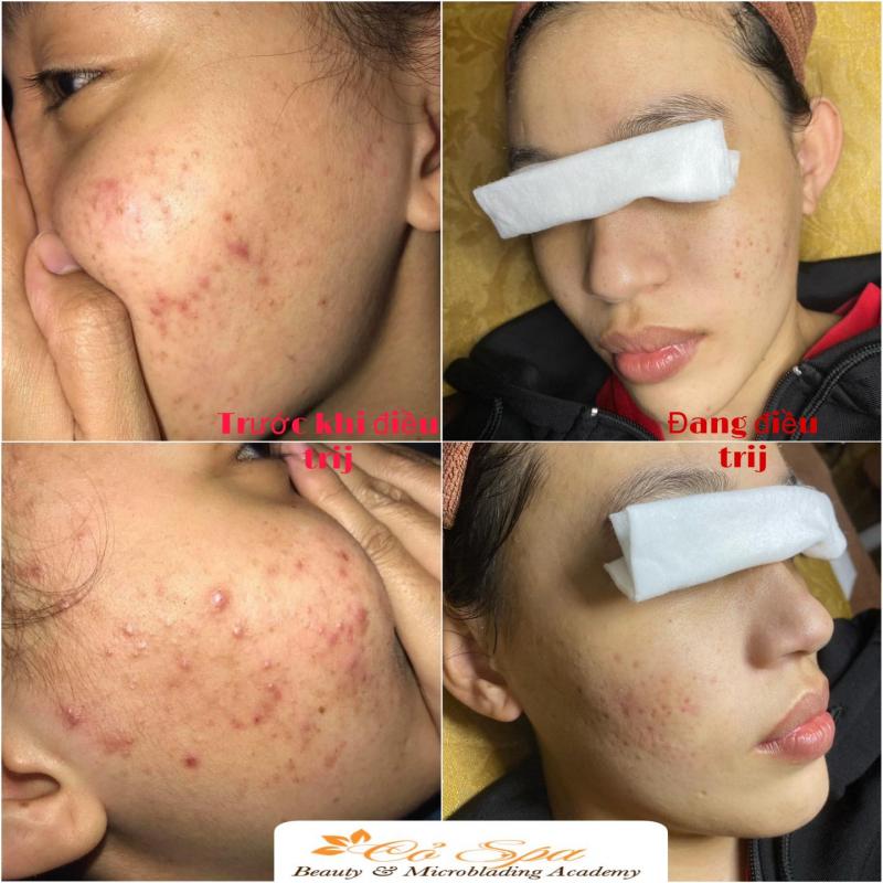 Cỏ Spa