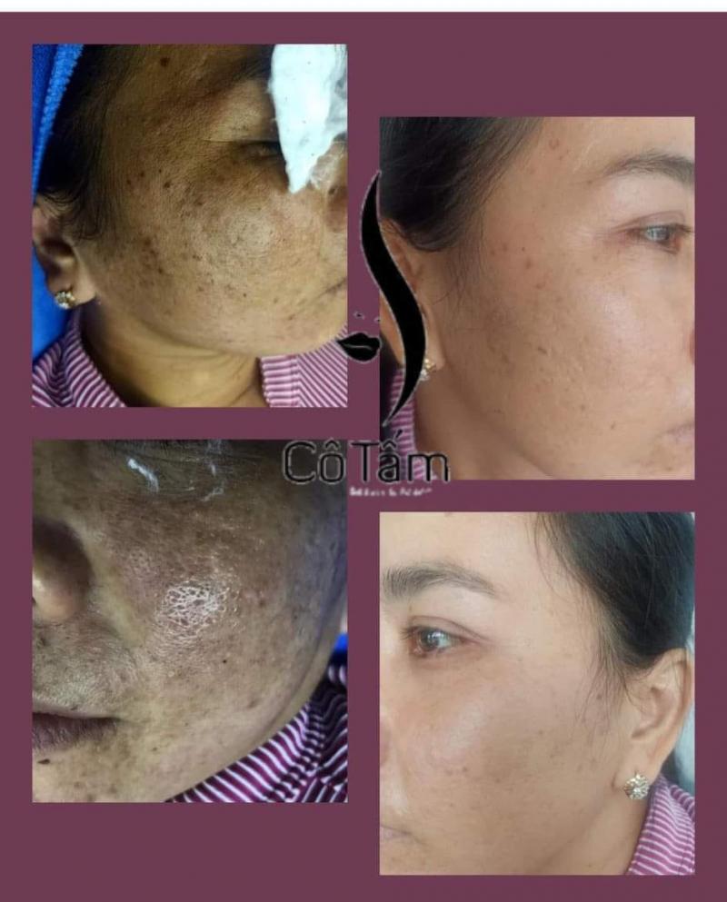 CÔ TẤM Beauty SPA