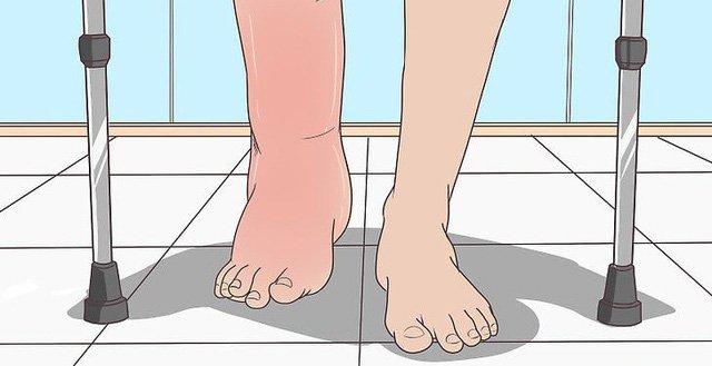 Cơ thể có dấu hiệu sưng, phù nề