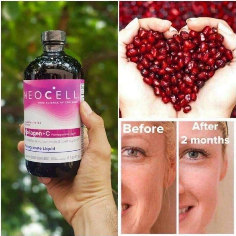 Collagen +C lựu NeoCell Pomegranate Liquid 4000mg