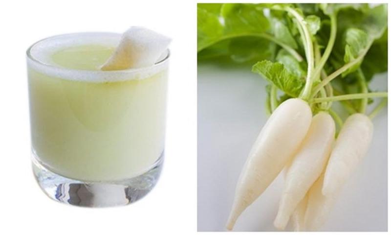 Củ cải