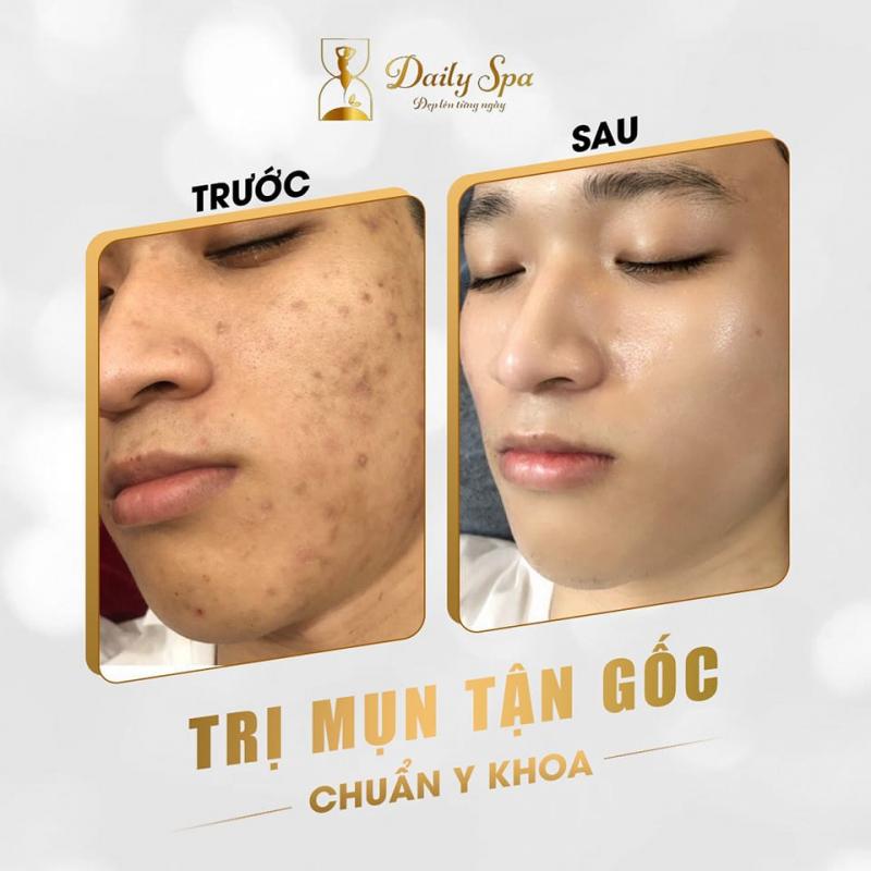 Daily Spa