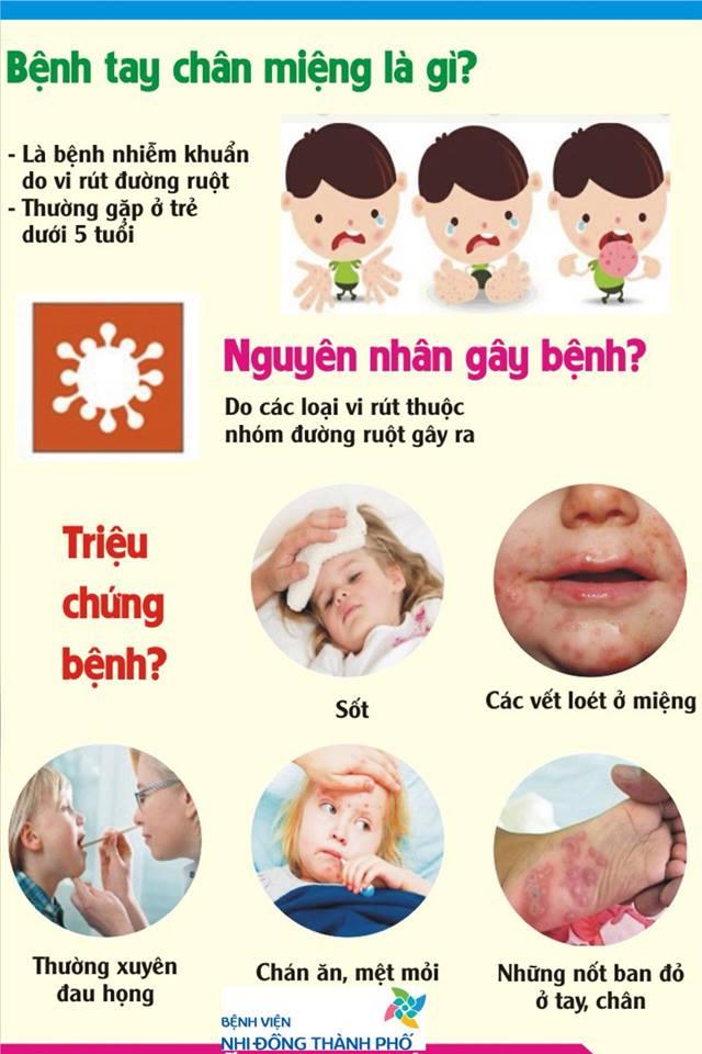 Dấu hiệu nhận biết bệnh tay chân miệng ở trẻ nhỏ