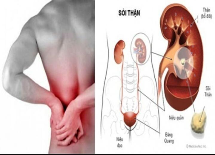 Đau lưng
