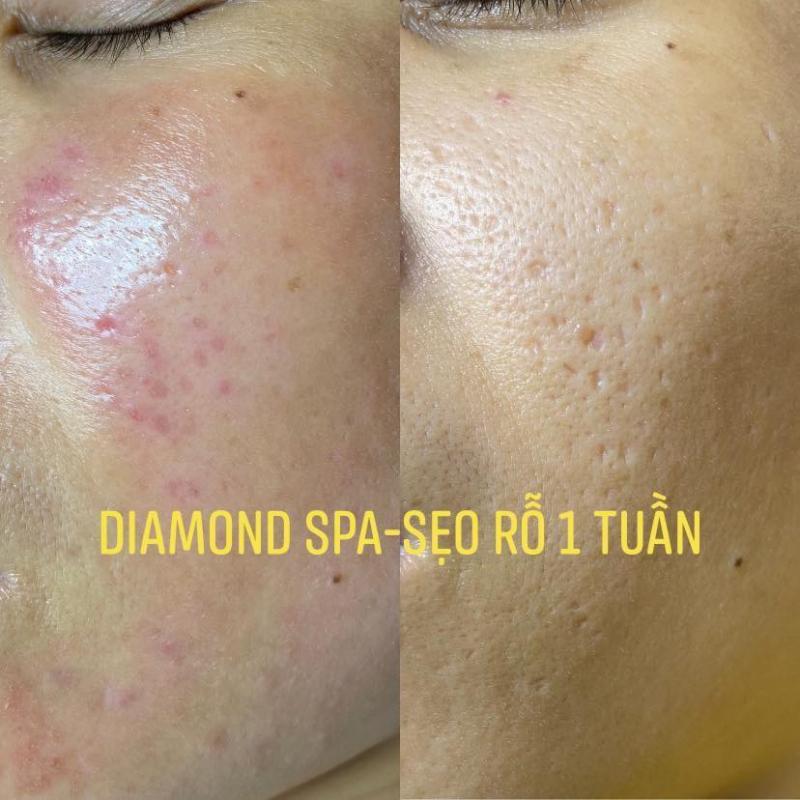 Diamond Spa