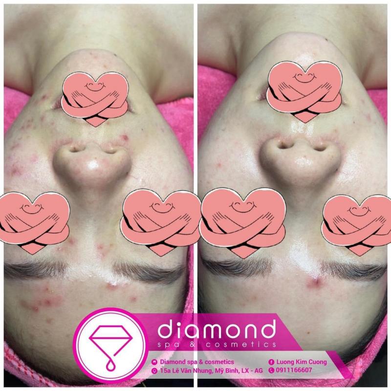 Diamond Spa & Cosmetics