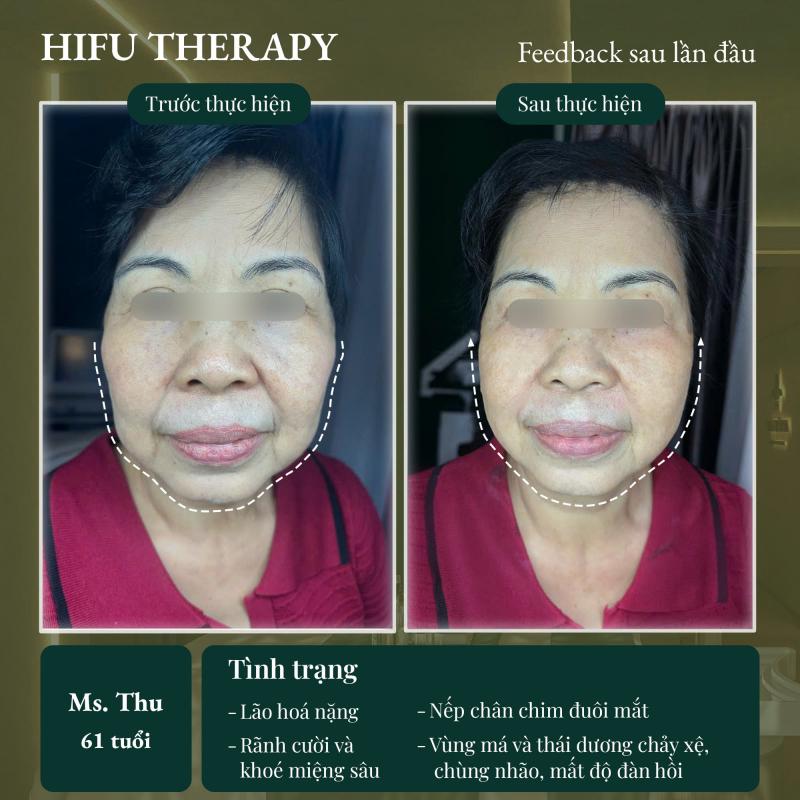 Diên Vĩ Spa