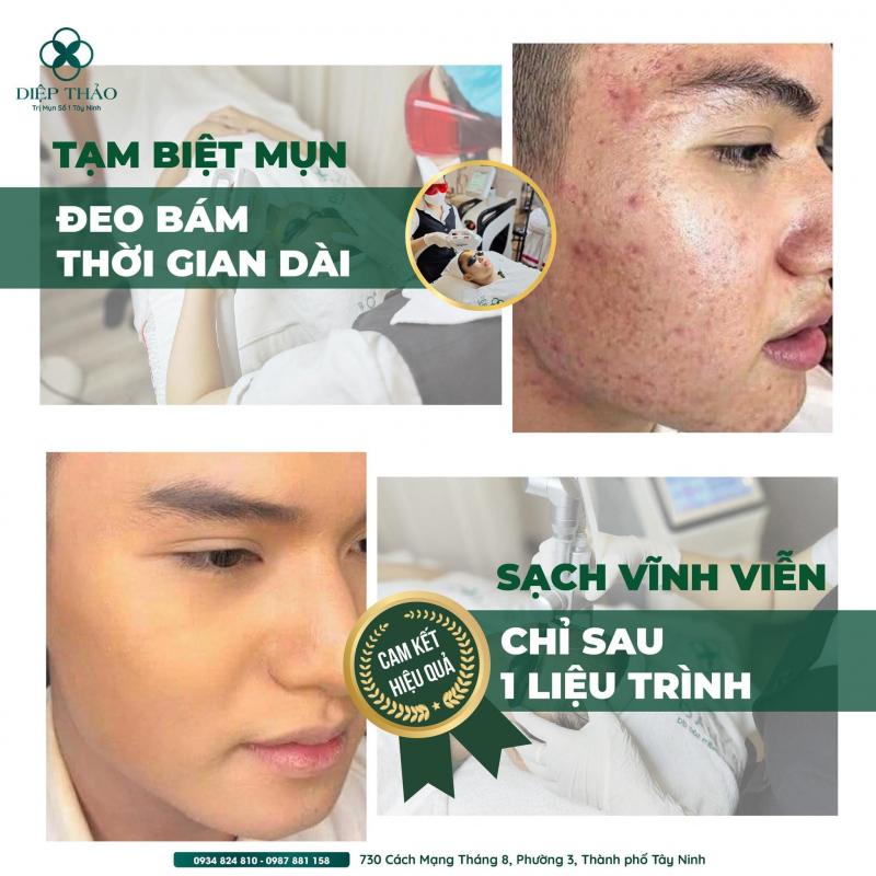 Diệp Thảo Medi-Spa